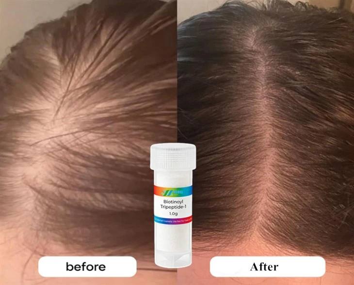 Biotinoyl Tripeptide-1 hair growth